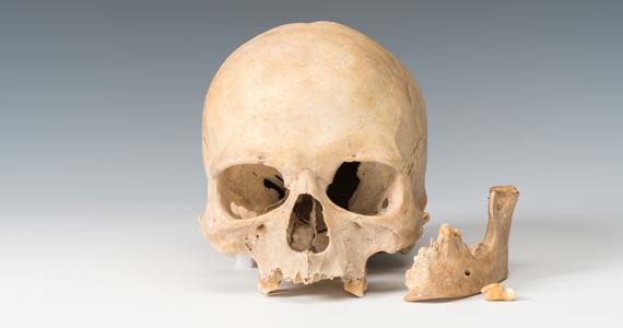 Abb. 1: Carwitz, Lkr. Mecklenburgische Seenplatte. Der bei der Sandgewinnung am oder auf dem Hauptmannsberg entdeckte Frauenschädel.